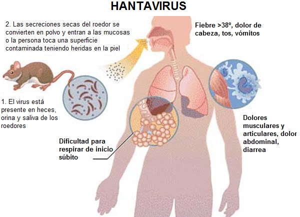 Casilda: muere una mujer por hantavirus