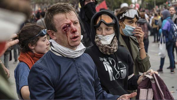 Decenas de heridos por brutal represión en Paris, un manifestante pierde un ojo