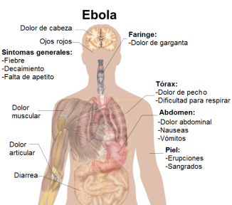 Ébola: qué es y cómo se contagia