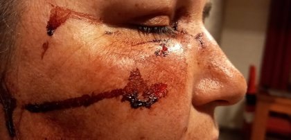 Brutal golpiza lesbofóbica en Lampa: mujer fue pateada en la cabeza y la trataron de “sucia”