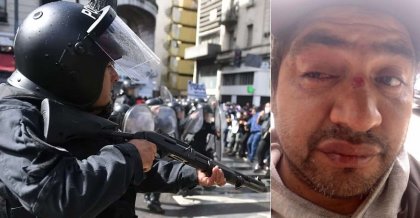 Represión a jornada piquetera: un manifestante perdió la visión de un ojo