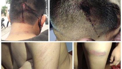 Brutal golpiza policial a jóvenes y vecinos de Alto Comedero en Año Nuevo