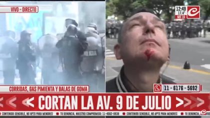 Ataque a la prensa: balazos de goma en la cara y detención de periodistas en la 9 de Julio