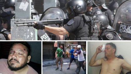 Varios manifestantes perdieron un ojo porque la Policía pegó y disparó a la cabeza