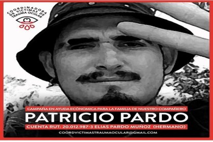 Trauma Ocular y Salud Mental: breve relato de experiencias traumáticas de algunas víctimas de la violencia estatal