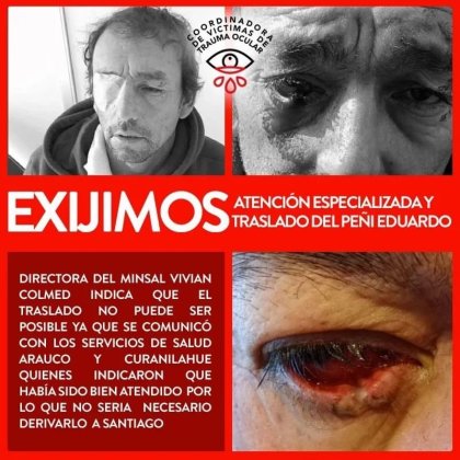 "Exigimos atención especializada y traslado del Peñi Eduardo": Coordinadora de víctimas de trauma ocular denuncia al gobierno 