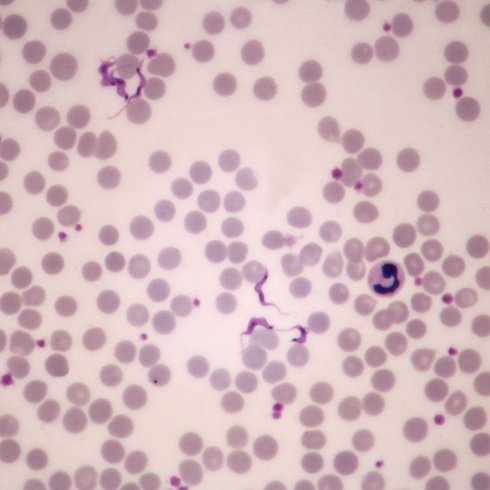 Imágenes al microscopio óptico con técnica de tinción. 