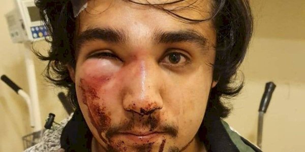 Brutal golpiza de carabineros a joven de las juventudes socialistas en Puerto Montt