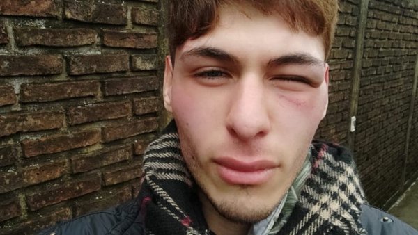 Ataque homofóbico a estudiante de Periodismo en La Plata