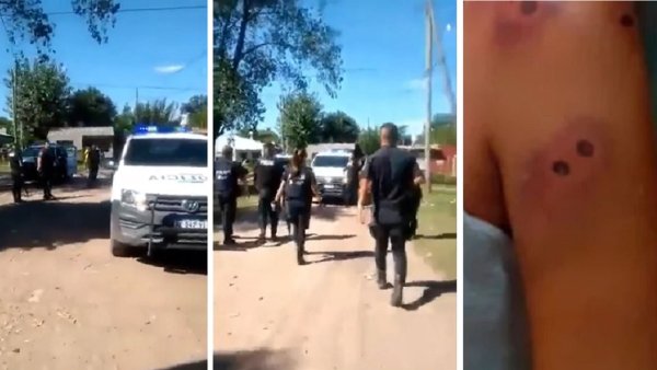 Merlo: la Bonaerense hirió a una beba de 5 meses en la cabeza de un balazo de goma