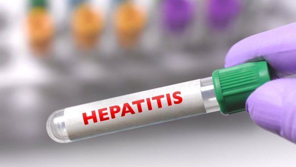 Primer caso de hepatitis aguda infantil en Argentina