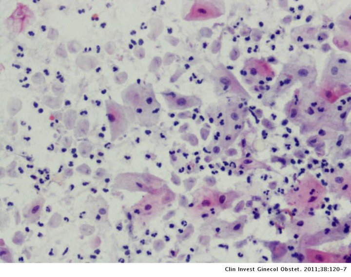 Imágenes al microscopio óptico con técnica de tinción.